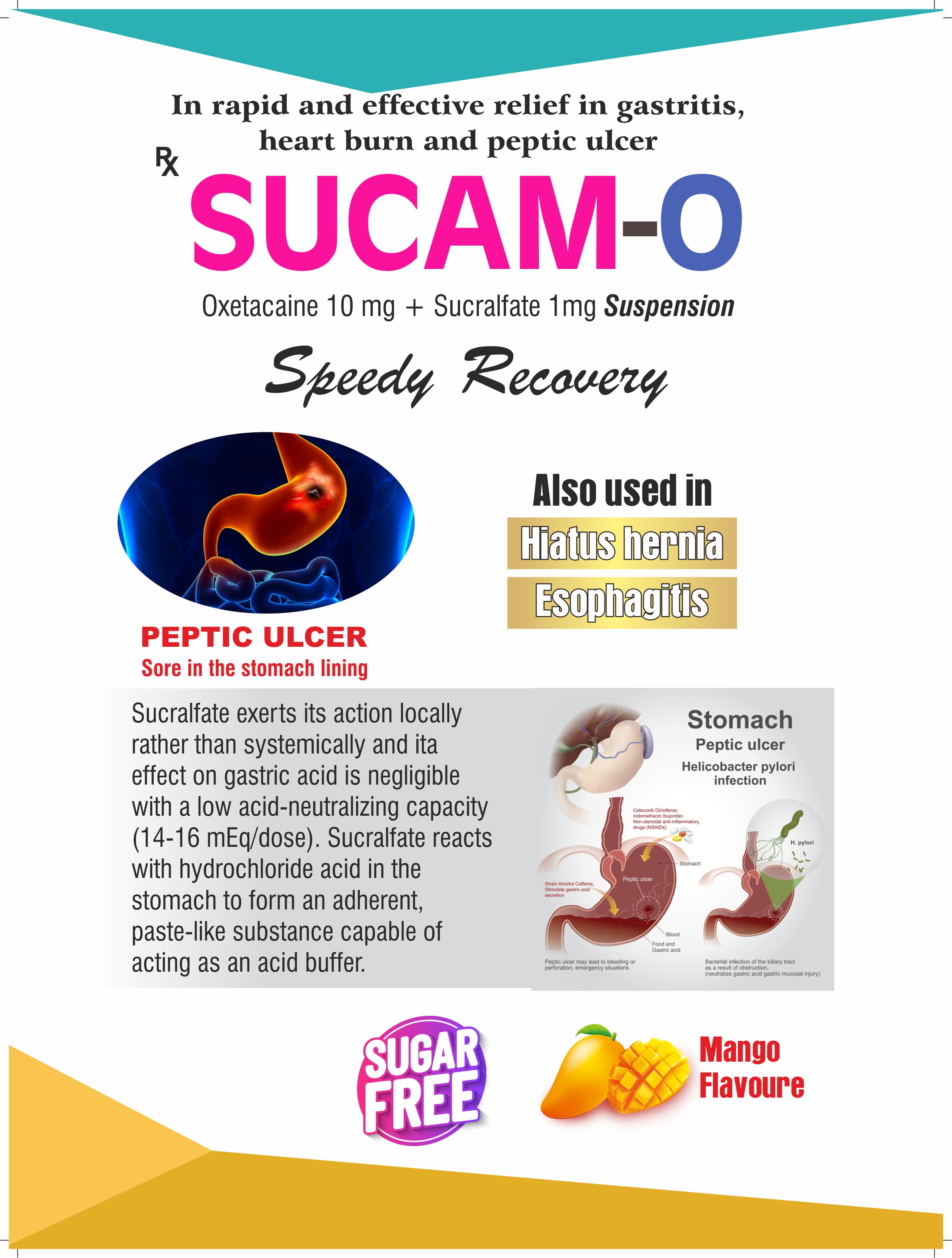 SUCAM-O